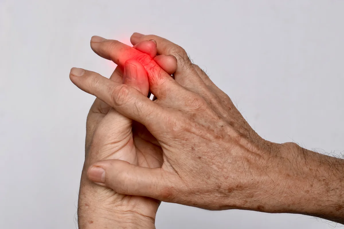 L’arthrose des doigts