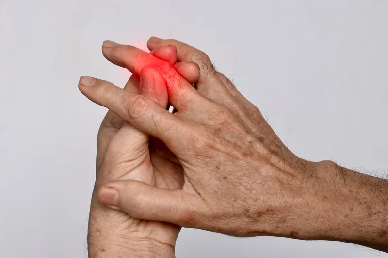 L’arthrose des doigts